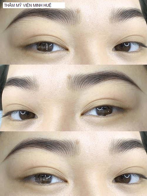 Hình ảnh THẨM MỸ VIỆN MINH HUỆ
