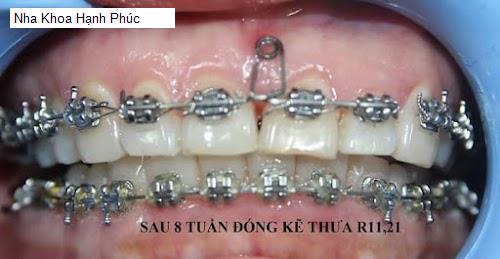 Hình ảnh Nha Khoa Hạnh Phúc